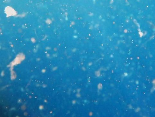 Mikroplastik